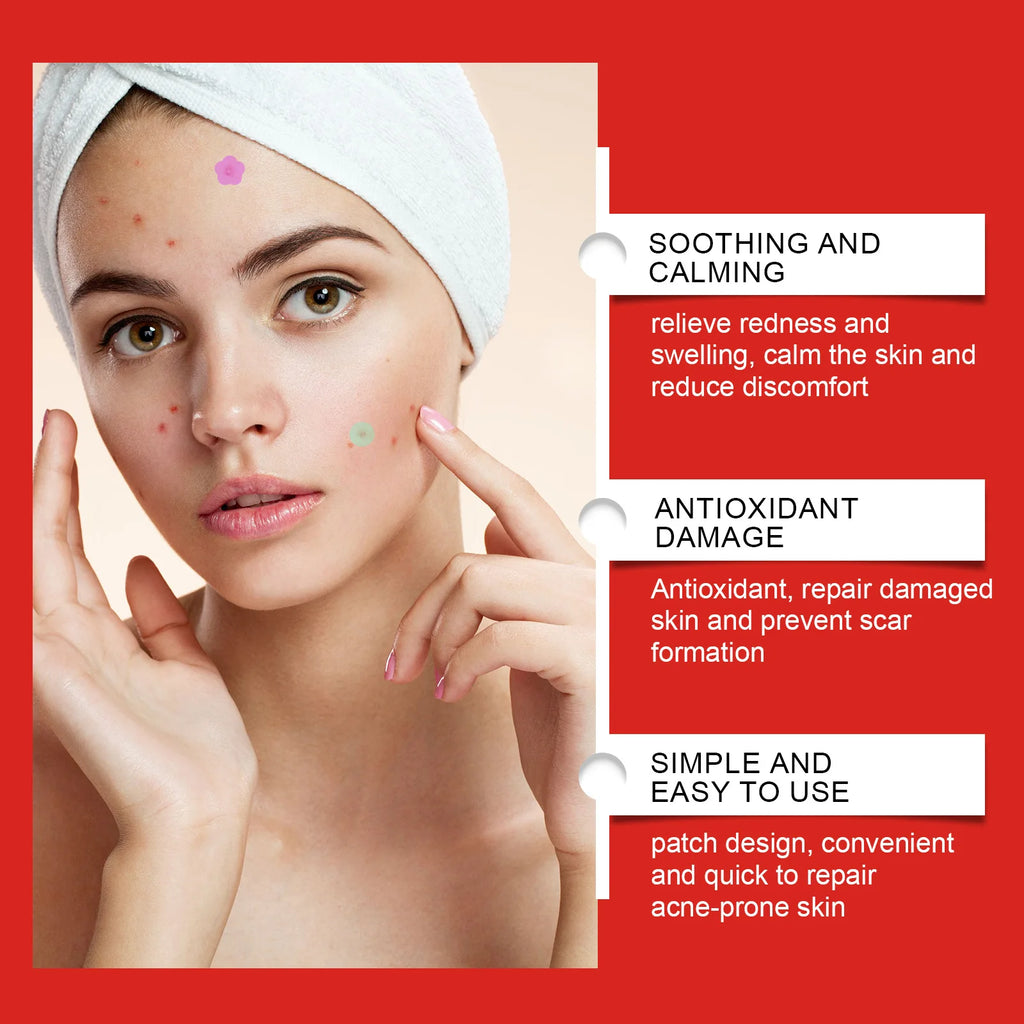 1/2/3 Box Acne Pimple Patches
